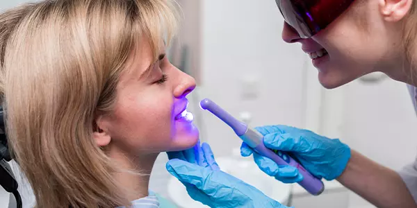 tratamiento_blanqueamiento_dental_profesional