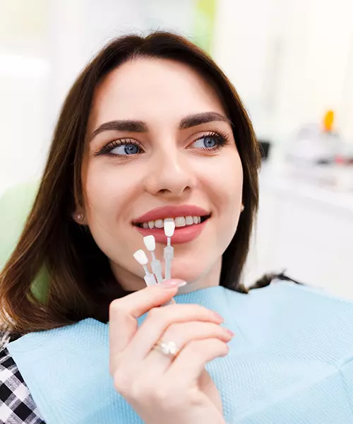 carillas_dentales_esteticas