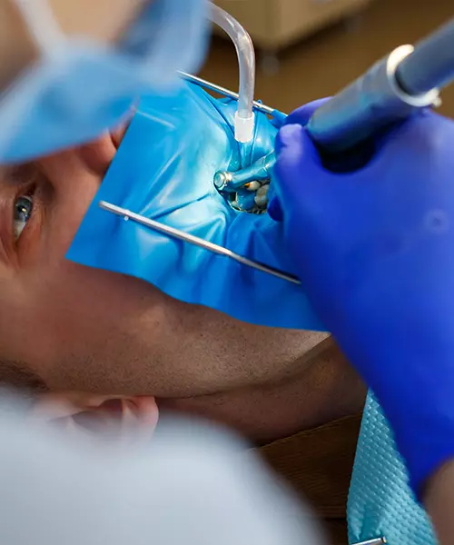 cirugia_tercer_molar