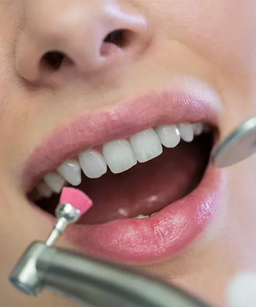 consulta_dental_general