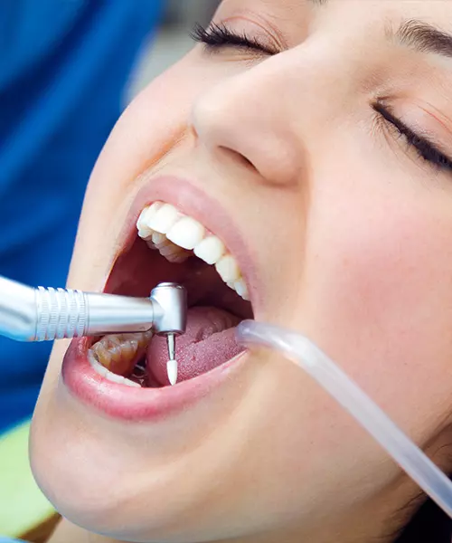 endodoncia_tratamiento