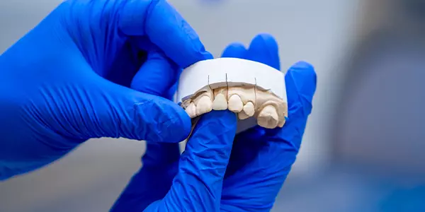 protesis_dentales_a_medida