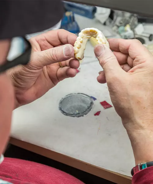 prostodoncia_rehabilitacion_oral